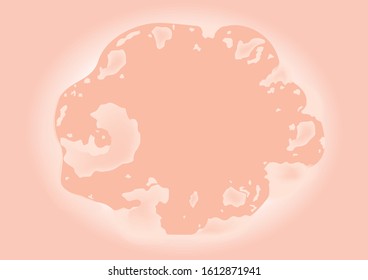 Dry skin texture vector	 on white background