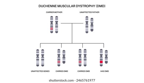 Duchenne muscular dystrophy inheritance pattern. Hereditary neuromuscular disease. Progressive muscle fiber degeneration and weakness. Affected, carriers or healthy chromosomes vector illustration.