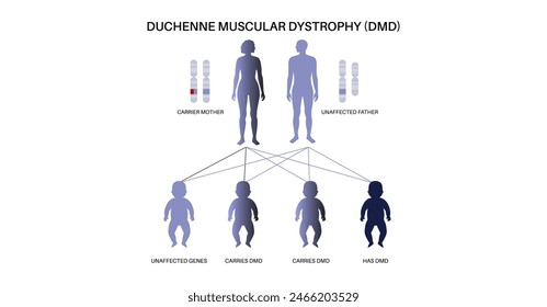 Duchenne muscular dystrophy inheritance pattern. Hereditary neuromuscular disease. Progressive muscle fiber degeneration and weakness. Affected, carriers or healthy chromosomes vector illustration.