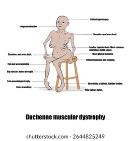 Distrofia muscular de Duchenne, uma doença hereditária caracterizada por fraqueza muscular progressiva.