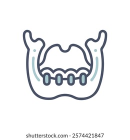 Dynamic Overview of Maxilla Anatomy Illustration