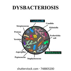 Dysbacteriosis Intestine Lactobacillus Bifidobacteria Streptococcus ...