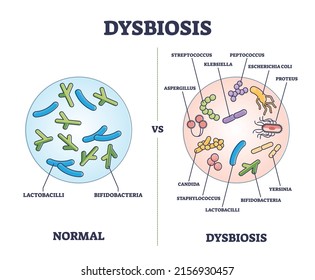 Dysbiosis versus normal gut or tract microflora with bacteria outline diagram. Labeled educational scheme with digestive system differences vector illustration. Microscopic microbe flora comparison.