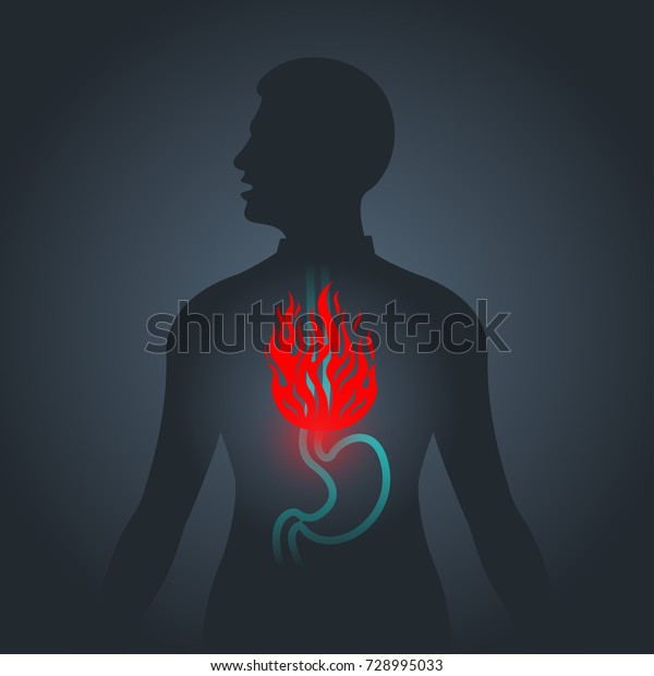 Dyspepsia vector logo icon illustration