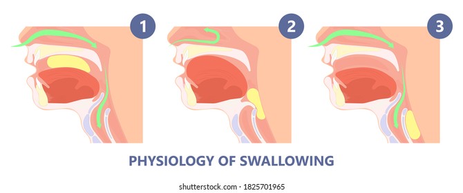Dysphagia infection trachea examine Surgery choking gastric symptoms diagnose windpipe disorder bleeding surgical GERD treat tumor throat biopsy system ulcers stomach blocked eating food stuck test