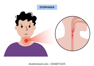 Dysphagia medical poster. Difficult or painful swallowing. Esophagus disease concept. Difficulty in the passage of solids or liquids from the mouth to the stomach. Digestive tract problem flat vector