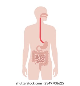 Dysphagia medical poster. Difficult or painful swallowing. Esophagus disease concept. Difficulty in the passage of solids or liquids from the mouth to the stomach. Digestive tract problem flat vector