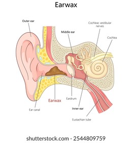 ear anatomy showing earwax in the ear canal, labeling outer, middle, and inner ear structures for educational purposes diagram hand drawn vector illustration. Medical science educational illustration