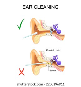 Ear Cleaning with a cotton swab. Earwax Removal. Cross section of human's ear. Vector poster