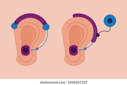 Ear icons wearing hearing aids. Deaf ears wearing hearing aids, device. Hearing loss, deafness concept. 