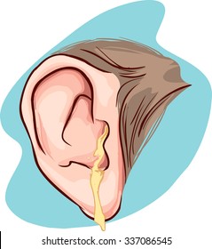 Ear Infection