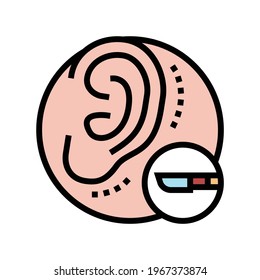 ear surgery color icon vector. isolated symbol illustration