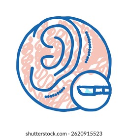 ear surgery doodle icon sketch vector. ear surgery sign. isolated symbol illustration