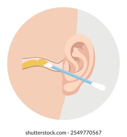 Ohrenschmalz mit Ohrstöpsel-Anatomie