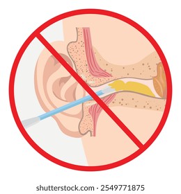 Ear wax with using ear stick anatomy. Warning using q tip