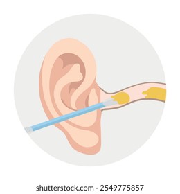 Ear wax  with using ear stick anatomy