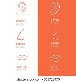 Ears, nose and lips reshaping before and after surgery. Abstract illustration isolated .Template for business card and banner