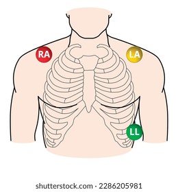 ECG 3-Wire Cable Lead Position - RA,LA,LL - Vector Medical Illustration