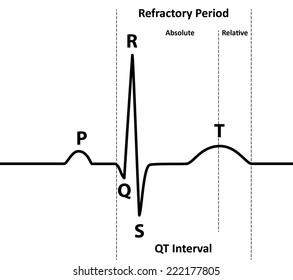 Ecg Absolute Relative Refractory Periods Black Stock Vector (royalty 