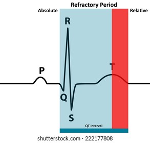 Ecg Absolute Relative Refractory Periods Color Stock Vector (Royalty ...