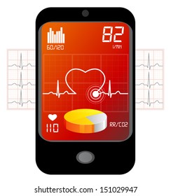 ECG Analysis Over Mobile Phone