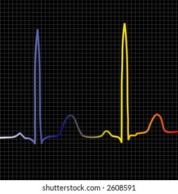 Una pantalla de ecg para mostrar latido de corazón o información relacionada con el equipo