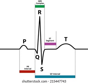 ECG / EKG Normal Sinus Rhythm With Wave And Segment Names