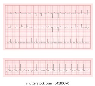 ECG Heart Chart Scan Vector Illustration