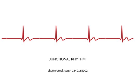 EKG Heartbeat Line. Vektorillustration des Elektrokardiogramms. Rhythmus