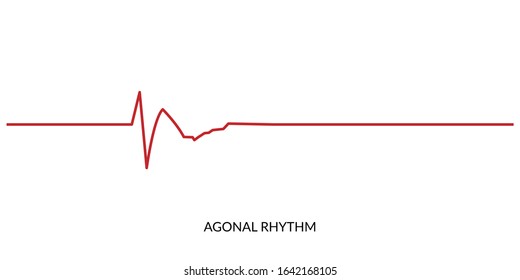 ECG Heartbeat Line. Electrocardiogram vector illustration. Agonal Rhythm