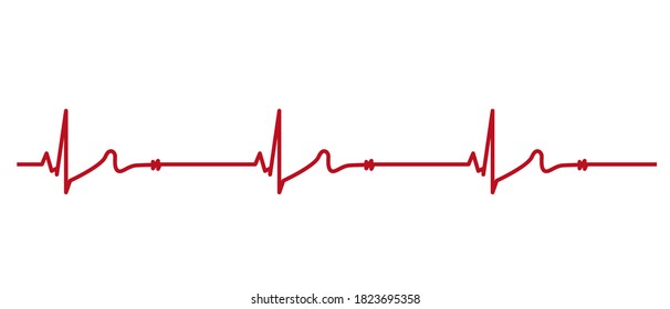 ECG Heartbeat Line. Electrocardiogram vector illustration. Sinus Bradycardia. Vector