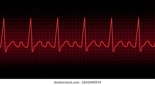 Monitor de pulsação do ECG. Pulso cardíaco do cardiograma. Ilustração vetorial