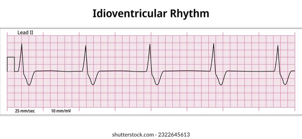 ECG Idioventricular Rhythm - 8 Second ECG Paper - Electrocardiography Medical Vector Illustration