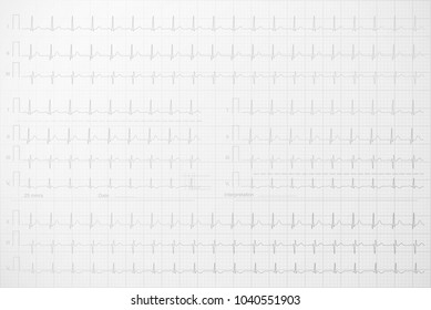 ECG lines on the paper background, vector illustration.