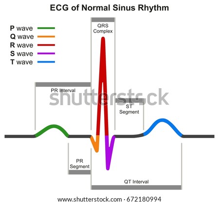 ECG of Normal Sinus Rhythm infographic diagram showing normal heart beat wave including intervals segments and complex for medical science education and health care