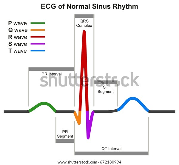 Ecg Normal Sinus Rhythm Infographic Diagram Stock Vector Royalty Free