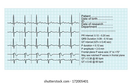 ECG on paper. vector. Suitable for professional use