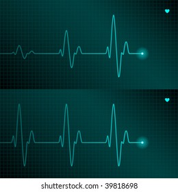 ECG tracing. Vector.