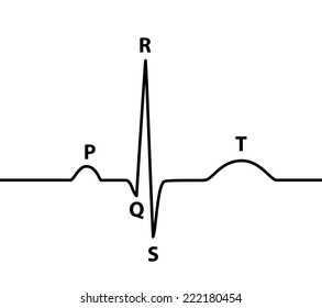 Ecg Absolute Relative Refractory Periods Color Stock Vector (Royalty ...