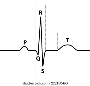 Ecg Waveform Labels Dotted Lines Stock Vector (Royalty Free) 222180460 ...