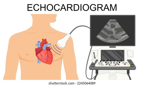 Echocardiogram. Heart ultrasound.  Medical Vector illustration of Echocardiogram for articles, posters, banners.  Cardiology Echo test. Diagnose cardiac problem. Preventing, diagnosing a heart attack.