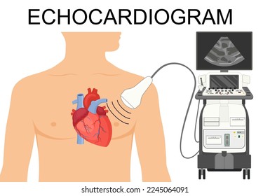 Echocardiogram. Heart ultrasound.  Medical Vector illustration of Echocardiogram for articles, posters, banners.  Cardiology Echo test. Diagnose cardiac problem. Preventing, diagnosing a heart attack.