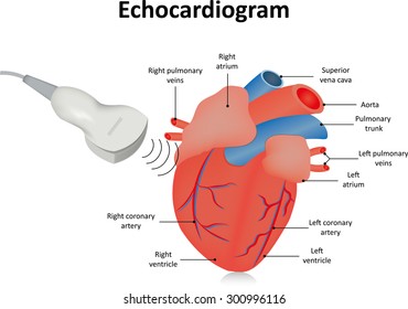 Echocardiogram (Ultrasound of the Heart)