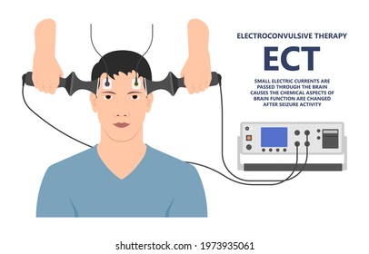 ECT treat MDD Major TMS electric current brain mental health mania bipolar loss Physical head EEG activity signal severe OCD therapist shock deep anxiety Post disease emotional Stigma