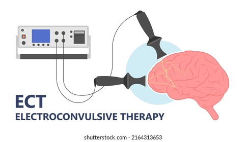 ECT treat MDD Major TMS electric current brain mental health mania bipolar loss Physical head EEG activity signal severe OCD therapist shock deep anxiety Post disease emotional Stigma