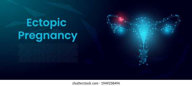 Ectopic Pregnancy Concept Female Reproductive System Stock Vector