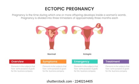 ectopic pregnant or pregnancy infographic concept for slide presentation with 3 point list