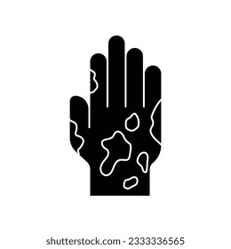 Eczema hand ski icon design. Rash hand icon, allergic reaction. isolated on white background. vector illustration