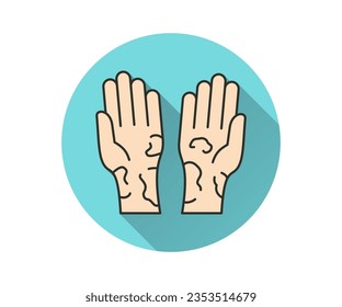Eczema treatment flat icon. Simple illustration with long shadow for graphic and web design.