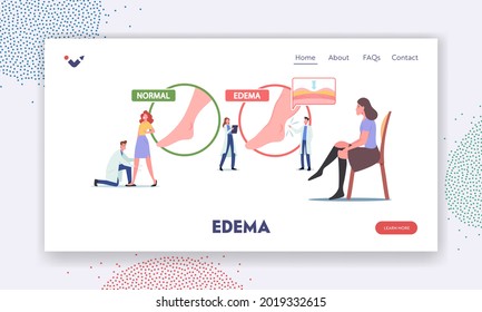 Edema Disease Landing Page Template. Tiny Doctor and Patient Characters at Huge Infographics Presenting Healthy and Diseased Legs, Woman Wear Compression Stockings. Cartoon People Vector Illustration